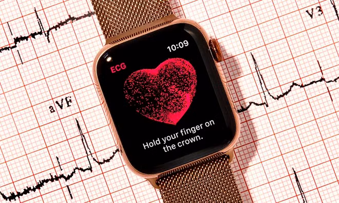 Watch SE thiếu tính năng ECG cho phép theo dõi điện tâm đồ, cảnh báo nhồi máu cơ tim. Tuy vậy, Watch SE vẫn có thể đo nhịp tim giống như Series 3, nhưng sẽ chỉ thông báo nếu như bạn có nhịp tim cao, thấp bất thường.