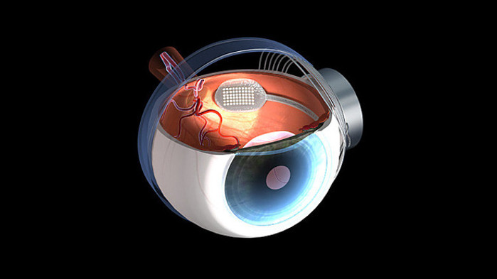 Hiện tại, mắt bionic đã được lên kế hoạch phát triển rộng rãi trong 5 năm tới dưới cái tên EC-EYE, viết tắt của Electro Chemical EYE.