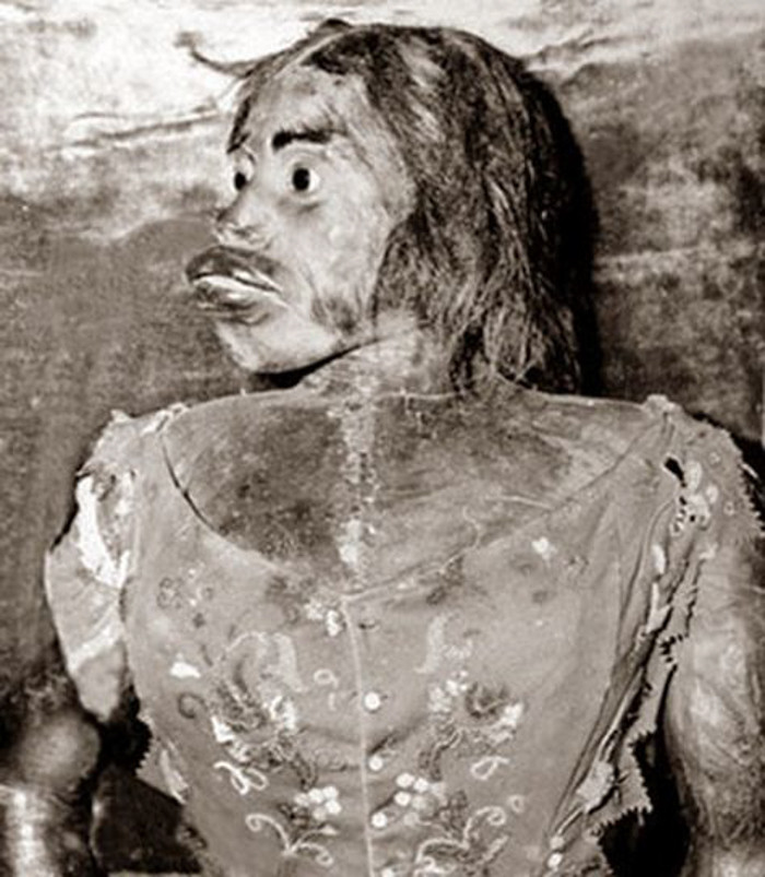 Thực chất, Ngay từ khi mới chào đời, Julia đã bị ảnh hưởng bởi một hội chứng đột biến gen di truyền khiến khắp cơ thể đều bị bao phủ bởi một lớp lông dày. Không những thế, bà còn bị bệnh tăng sản về nướu khiến cho lợi và môi rất dày và hàm trước nhô ra.