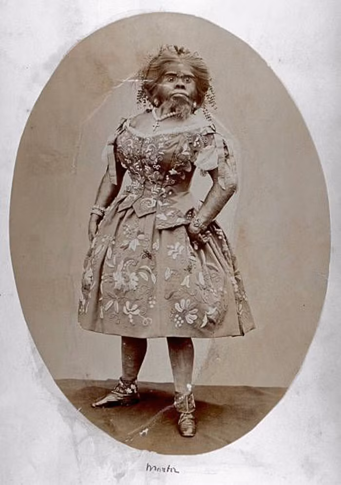 Trong mắt của công chúng, Julia Pastrana thực sự đã có một màn ra mắt thật ly kì. Thân thể bà phủ đầy lông lá, khuôn mặt cũng đầy lông như vậy.