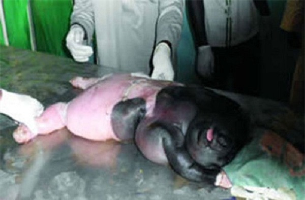 Các bác sĩ thú y tại Nigeria đã mất nhiều công sức giúp cừu mẹ sinh ra bào thai "nửa vật nửa người" này.