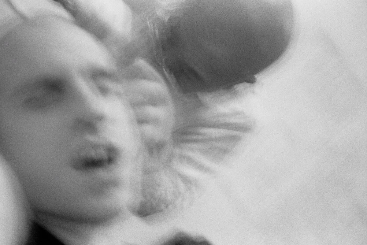 Năm sau, anh bắt đầu gắn một cặp vây vào hai bên đầu và thông báo ý định cấy ghép chúng vào hộp sọ của mình.