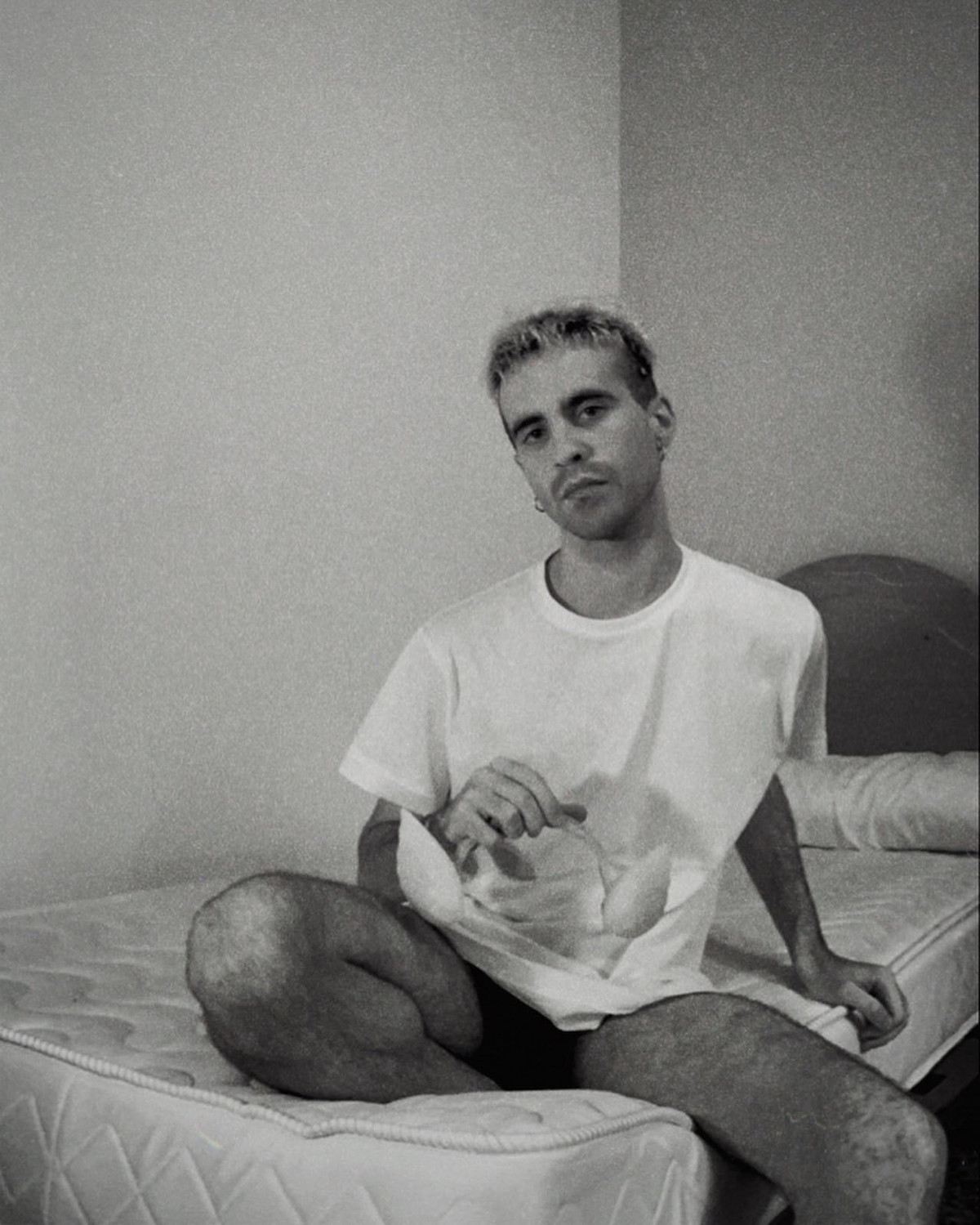 Vào thời điểm đó, thiết bị này không khác gì một bảng mạch hở được treo trên một chiếc băng đô ở sau đầu de Anguas.