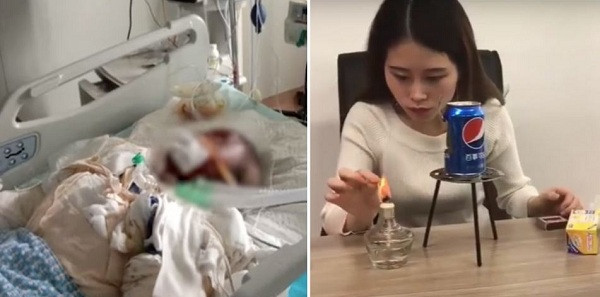 Những tưởng sự nghiệp sẽ trải đầy hoa hồng thì bỗng nữ Youtuber nổi tiếng xứ Trung vấp phải một scandal nghiêm trọng, ảnh hưởng không nhỏ đến cuộc sống và công việc của cô. Tháng 9/2019, hai bé gái bắt chước video làm bắp rang của Tiểu Dã không may gặp sự cố khiến 1 bé tử vong, bé còn lại bị thương.