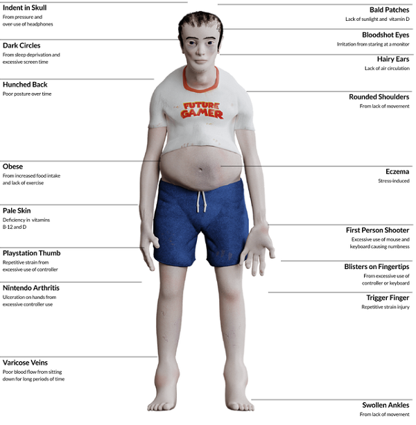 Theo đó, với nhân vật giả thuyết có tên Michael, nhóm nghiên cứu tìm hiểu và đưa ra những dấu hiệu sức khỏe và thể chất của con người trong 20 năm nữa nếu liên tục chơi game. Từ hình dạng bên ngoài đến bên trong cơ thể sẽ biến đổi tồi tệ đến không ngờ, giống như bị "tiến hóa ngược".