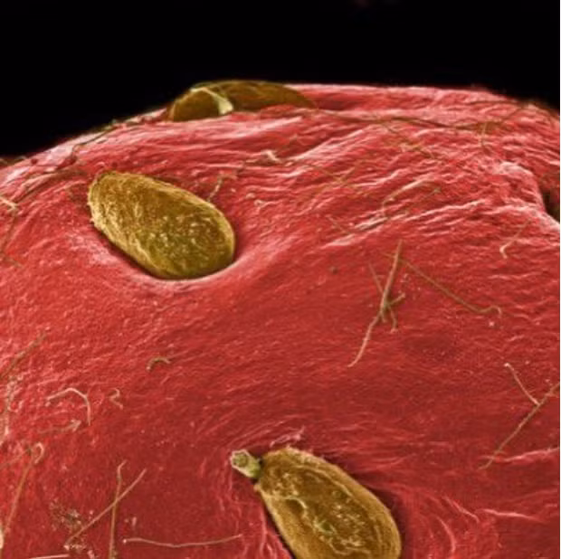 Không phải làn da bị mụn, đây là bề mặt của một quả dâu tây khi soi chiếu dưới kính hiển vi.