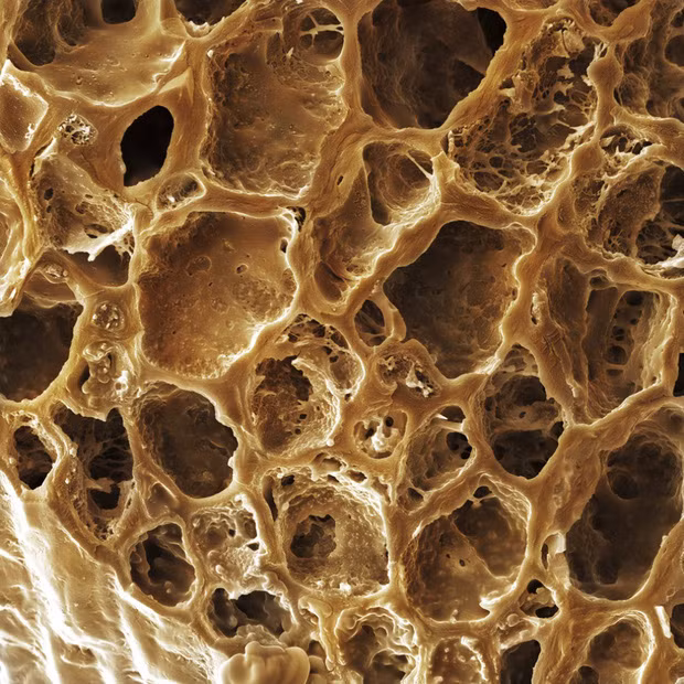 Đúng là cà phê rất ngon nhưng nếu bạn biết rằng đây là hình ảnh zoom cận của hạt cà phê rang xay thì chắc độ ngon của cà phê cũng giảm đi vài phần rồi.