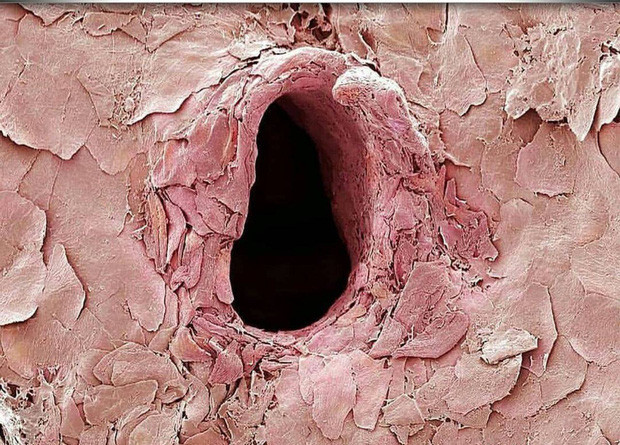 Đây là vết kim tiêm da người khi nhìn qua kính hiển vi.