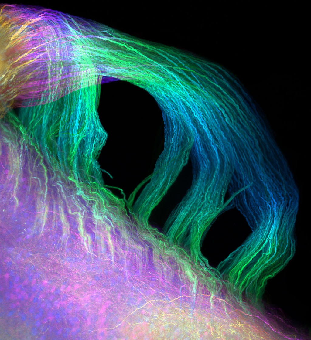 Tủy sống chuột sử dụng huỳnh quang GFP và làm nét bằng phương pháp CLARITY.