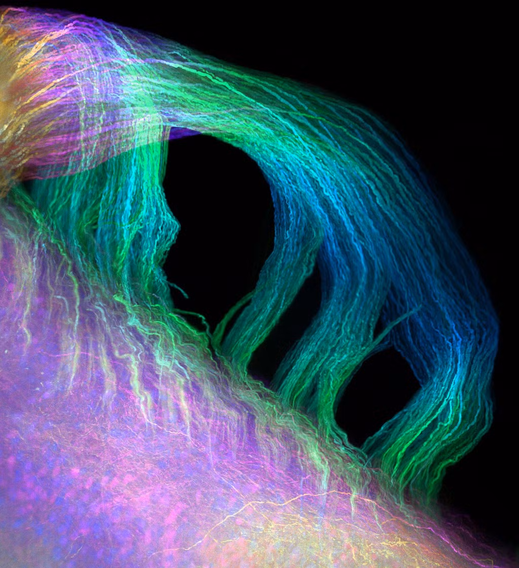 Tủy sống chuột sử dụng huỳnh quang GFP và làm nét bằng phương pháp CLARITY.