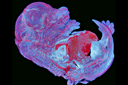 Lại là một hình ảnh liên quan đến chủ đề “chuột” chụp lại bởi Howard Vindin đến từ Australia. Điểm độc đáo của tấm ảnh là sự tự phát huỳnh quang của phôi chuột được gắn kết với nhau bằng 950 sợi cơ.