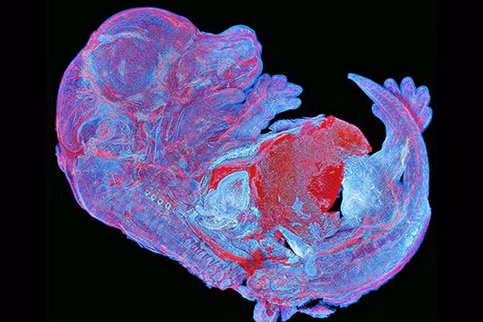 Lại là một hình ảnh liên quan đến chủ đề “chuột” chụp lại bởi Howard Vindin đến từ Australia. Điểm độc đáo của tấm ảnh là sự tự phát huỳnh quang của phôi chuột được gắn kết với nhau bằng 950 sợi cơ.