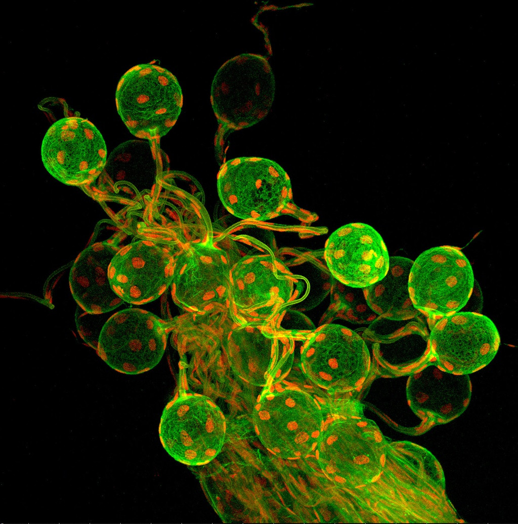 Buồng trứng của một con ong bắp cày anselmella dưới ống kính hiển vi trông thật đặc biệt.