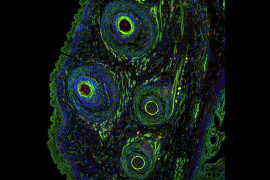 Bức ảnh giành chiến thắng ở khu vực châu Âu, Trung Đông và châu Phi được chụp nhờ việc kết hợp nhiều chùm tia huỳnh quang với phần mọc ria đã đông lạnh của một con chuột.