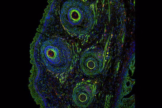 Bức ảnh giành chiến thắng ở khu vực châu Âu, Trung Đông và châu Phi được chụp nhờ việc kết hợp nhiều chùm tia huỳnh quang với phần mọc ria đã đông lạnh của một con chuột.