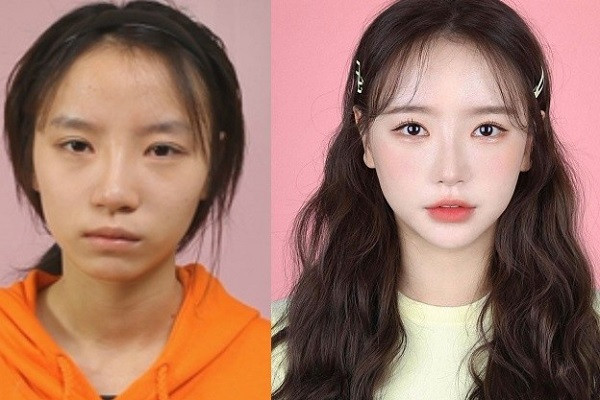 Han Areum Songee (sinh năm 1993) là hot girl nổi tiếng với hơn 400.000 lượt follow Instagram cá nhân. Cô nàng cũng là một trong số ít người đẹp tại xứ củ sâm thẳng thắn thừa nhận việc từng phẫu thuật thẩm mỹ để cải thiện nhan sắc.