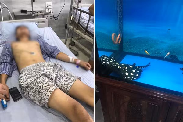 Mới đây, mạng xã hội xôn xao trước trường hợp hai người trong một gia đình phải nhập viện vì trúng nọc độc cá sam cảnh - loài cá vốn được coi thuộc top vật nuôi đẹp và đắt hàng đầu của dân chơi Việt. Câu chuyện được chia sẻ khiến không ít người hoang mang, đặc biệt là những người vốn đam mê và có thú chơi cá cảnh.