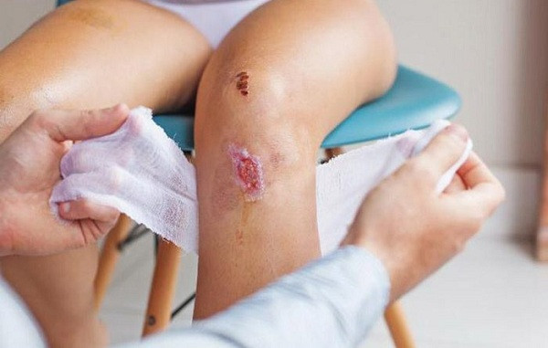 Một thứ được gọi là ''da phun'' đã từng được sáng chế để chữa những vết bỏng nặng trên da. Mảnh da nhỏ của bệnh nhân được xử lý bằng loại enzyme đặc biệt để trở thành dạng bột và hòa tan trong dung dịch sau đó phun lên chỗ bỏng, trong vòng 1 tuần thì khu vực bỏng rộng bằng tờ giấy A4 có thể hồi phục da.