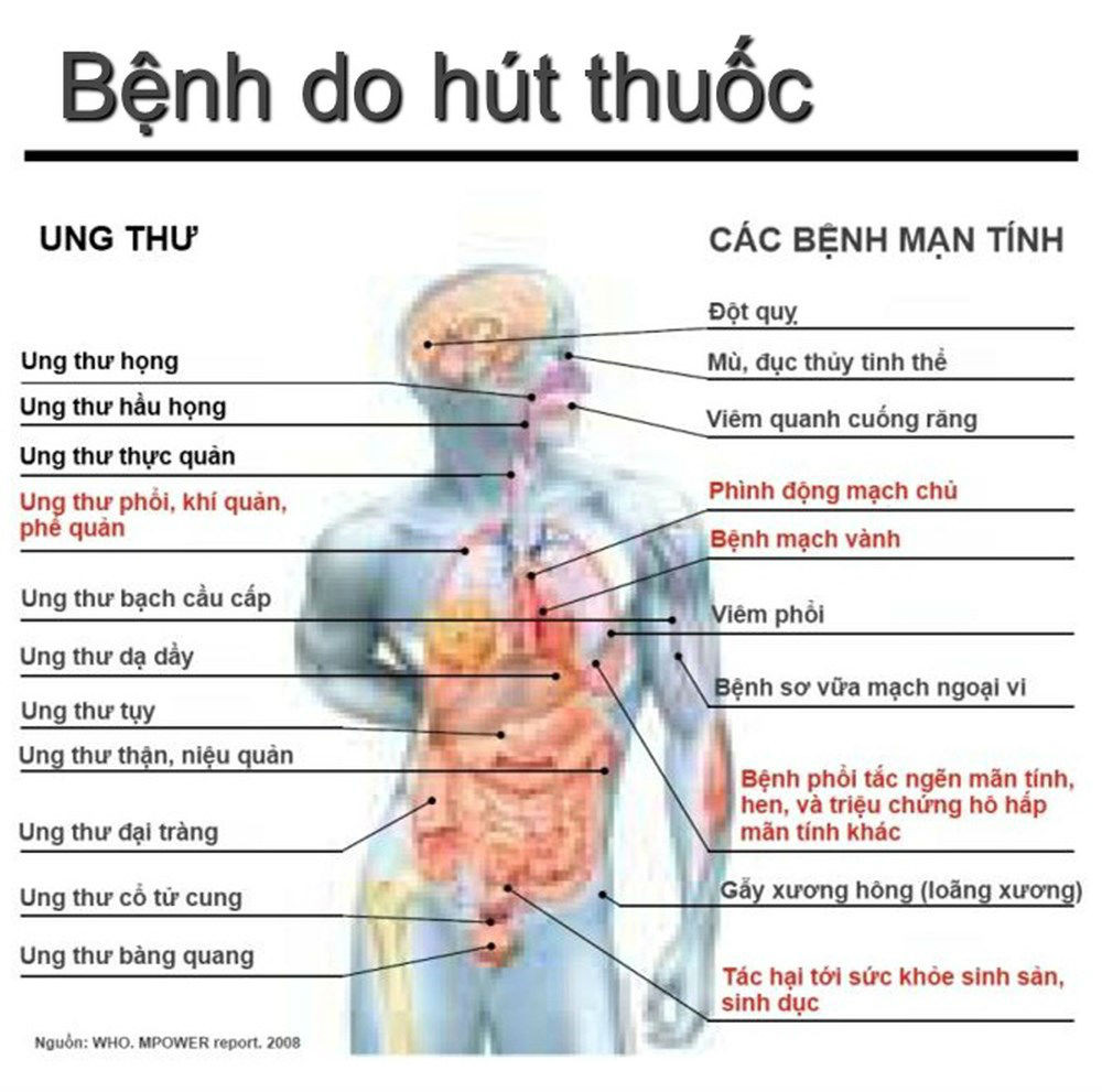 Hút thuốc lá là nguyên nhân dẫn tới hàng loạt bệnh ung thư
