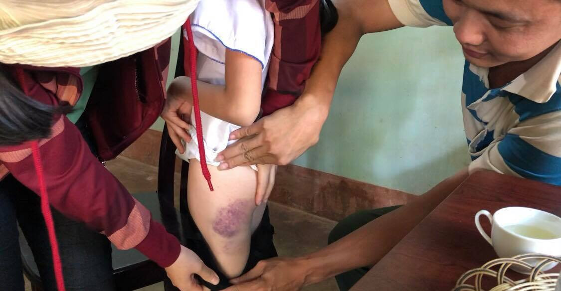 Co giao danh hoc sinh lop 4 tim mong vi khong biet viet-Hinh-2