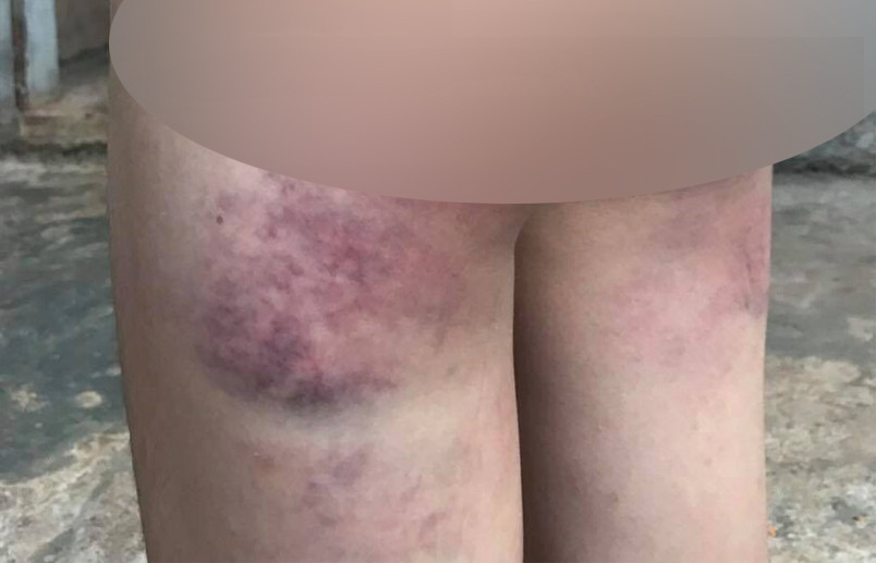 Co giao bi to danh hoc sinh lop 4 bam tim nguoi