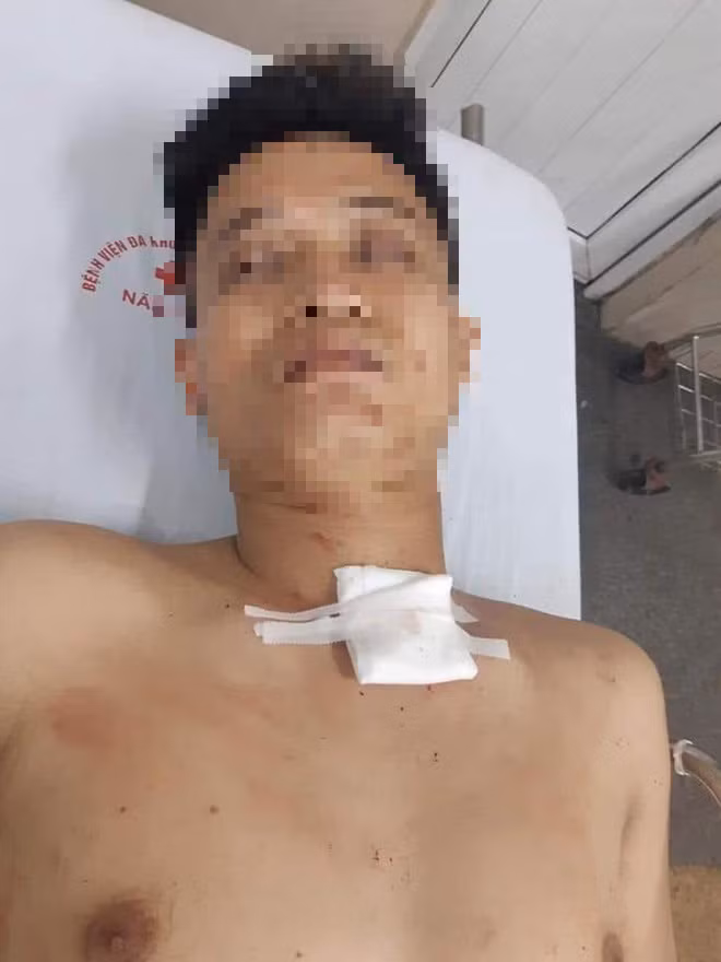 Lien tiep cac vu giet nguoi yeu gay hoang mang du luan-Hinh-2