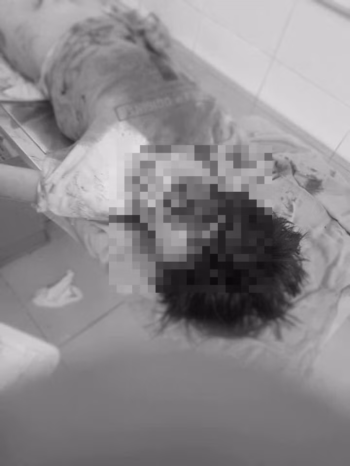 Tai xe lai xe dam, keo le be trai o Dong Anh sinh nam 1996-Hinh-2