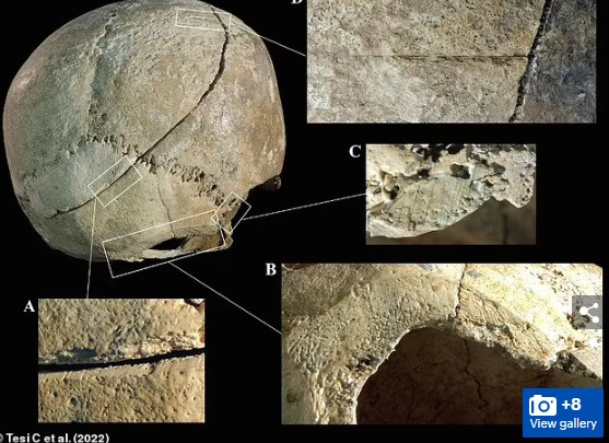 Nhờ vậy, nhóm nghiên cứu phát hiện người đàn ông trên có thể bị tấn công bất ngờ và không kịp bảo vệ phần đầu.