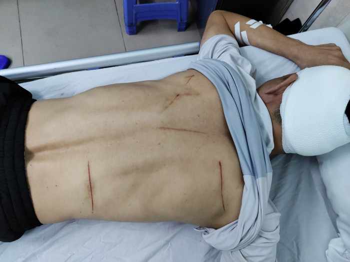 Lật mặt nhóm truy sát tài xế sau va chạm giao thông - Hình 2 Lat mat nhom truy sat tai xe sau va cham giao thong-Hinh-2