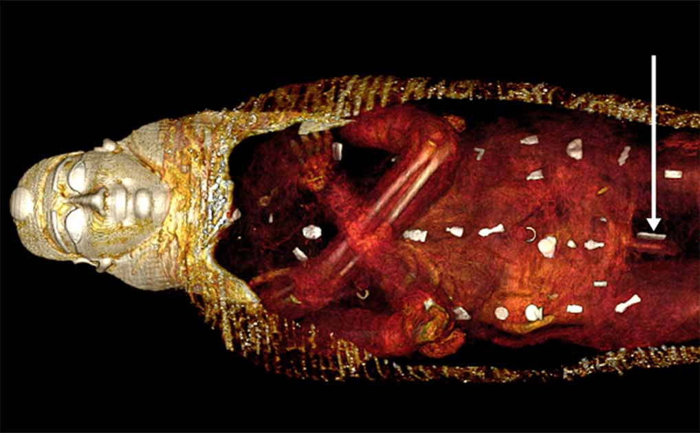 Sau khi được phát hiện, các chuyên gia chưa từng mở các lớp vải bọc xác ướp cậu bé vì sợ làm hư hại thi hài. Quan tài được đưa vào tầng hầm của Bảo tàng Ai Cập ở Cairo. Nghiên cứu gần đây được các chuyên gia tiến hành bằng phương pháp chụp cắt lớp CT nhằm bảo đảm sự nguyên vẹn của xác ướp "cậu bé vàng".