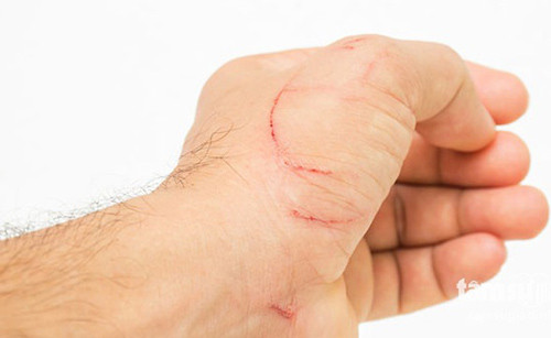 Tại cơ quan điều tra, Thà rất bình tĩnh, lời khai của anh ta về di biến động cũng hợp lý nhưng điều tra viên phát hiện trên tay Thà có nhiều vết xước. Khi được hỏi, Thà bảo bị ngã xe vào ngày mùng 1 Tết. Theo mô tả của Thà, công an tiến hành xác minh. Tuy nhiên những người sống gần nơi Thà nói bị ngã xe máy thì đều không hề biết gì về việc này. (Ảnh minh họa, nguồn internet)