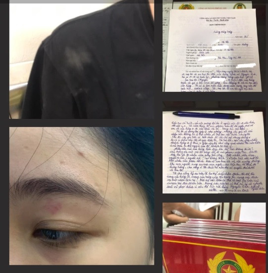 Nhân viên quán bánh mì Nguyên Sinh đánh khách: Chuyển hồ sơ công an quận Nhan vien quan banh mi Nguyen Sinh danh khach: Chuyen ho so cong an quan