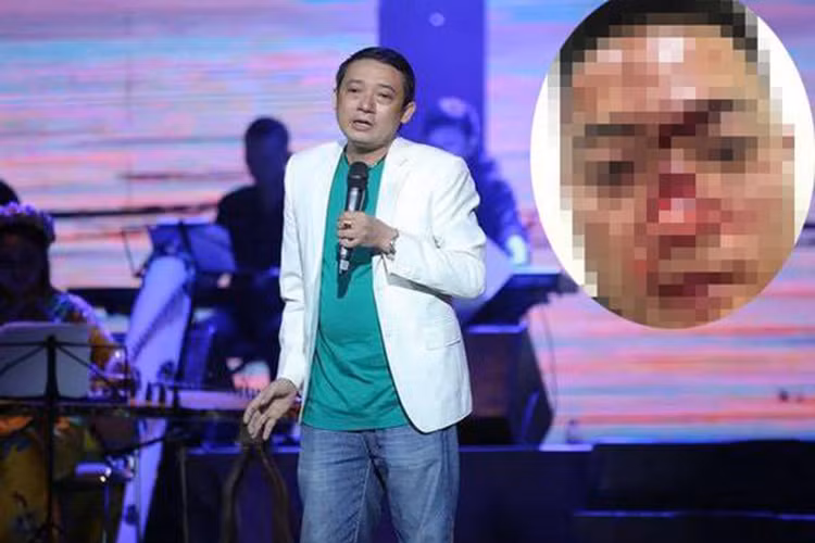 Không dừng lại ở đó, người quấy rối Chiến Thắng còn đăng lên mạng xã hội hình ảnh gương mặt đầy máu sau khi xô xát với lực lượng vệ sĩ của hội chợ kèm lời đe dọa nam danh hài. Ảnh: Vietnamnet