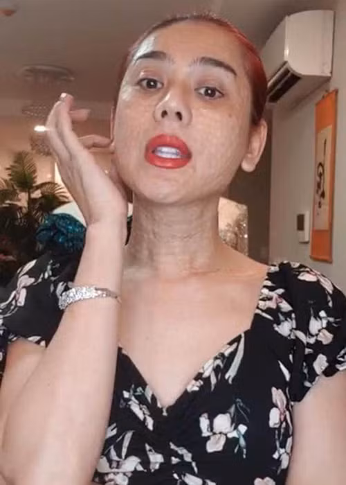 Đáp lại sự thắc mắc của người hâm mộ, nữ ca sĩ cho biết cô mới đi tân trang vùng mặt và cổ, hiện 2 vùng này vẫn còn sưng. Ảnh: Khám phá