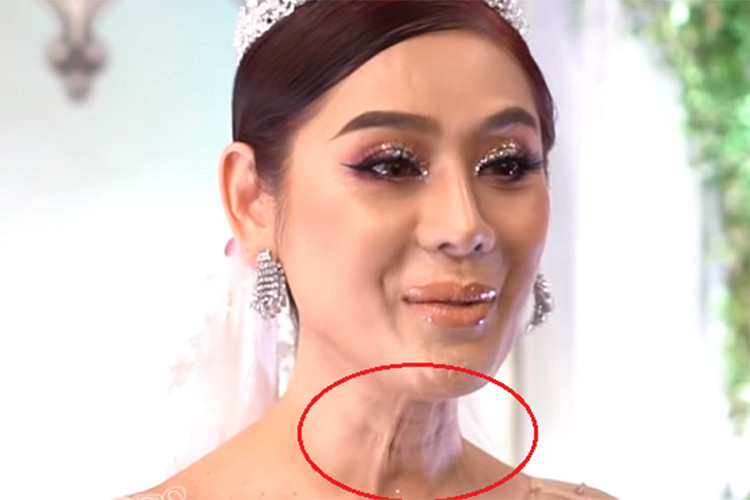 Nữ ca sĩ chuyển giới từng để lộ vùng da cổ nhăn nhúm, chảy xệ mỗi khi cất giọng. Ảnh: Vietnamnet