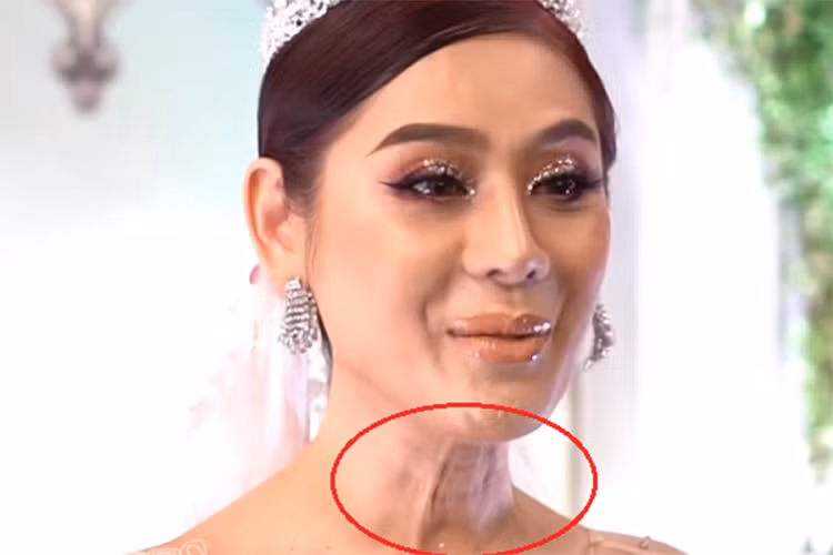 Nữ ca sĩ chuyển giới từng để lộ vùng da cổ nhăn nhúm, chảy xệ mỗi khi cất giọng. Ảnh: Vietnamnet