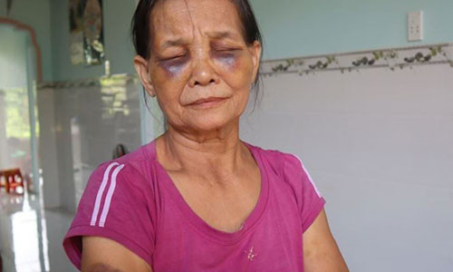 Con dau danh me chong tim mat o Binh Phuoc: Phat 2 trieu dong