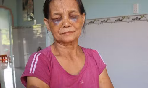 Con dau danh me chong tim mat o Binh Phuoc: Phat 2 trieu dong