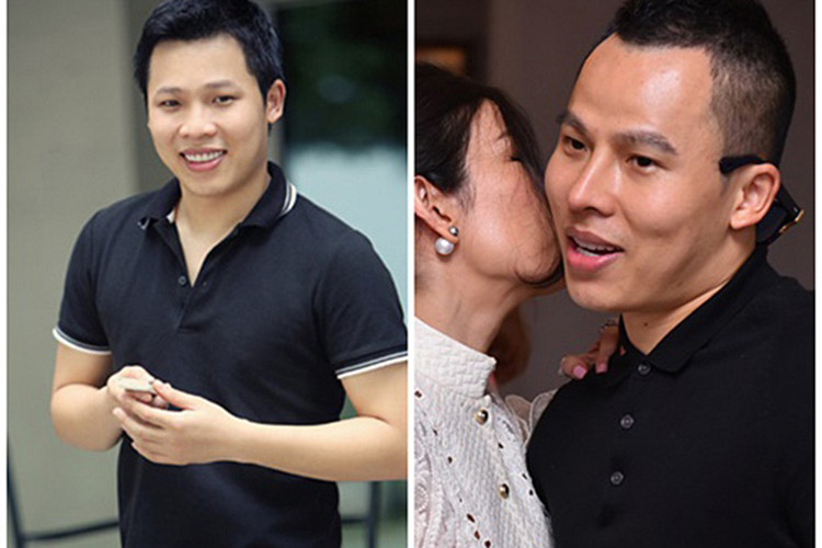 Khi bị đồn dao kéo, ông trùm chân dài đáp trả rằng sở dĩ có sự khác biệt đó là do anh đã biết cách cười. Thế nhưng, khi chiếc mũi thẳng giúp Vũ Khắc Tiệp nâng tầm nhan sắc trở nên bị lệch, xiêu vẹo khiến nhiều người đặt nghi vấn anh dao kéo hỏng. Ảnh: Vietnamnet