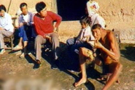 Theo ghi nhận, người này có vóc dáng khác thường với chiều cao quá khổ và các chi dài đột biến.