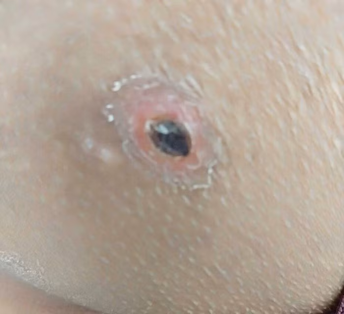 Sot cao, nam thanh nien suyt chet boi ly do khong ngo-Hinh-2