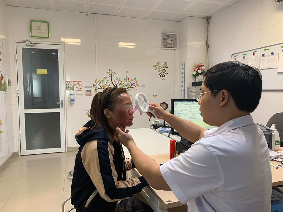 Các bác sĩ xác định hướng điều trị cho bệnh nhân là phải ngay lập tức dừng sản phẩm bôi, đồng thời chăm sóc da, sử dụng các sản phẩm làm dịu da, các thuốc bôi, uống và một số công nghệ ánh sáng phục hồi da. Sau 7 ngày điều trị tại bệnh viện, người bệnh đã không còn cảm giác bỏng rát, da mặt hết phù nề, giảm đỏ; lớp da bị bỏng đã bong tróc để lại nền da màu hồng. Hiện bệnh nhân tiếp tục dùng thuốc theo đơn điều trị. Ảnh: Vietnamnet.