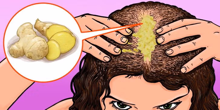 Dùng mặt nạ ủ bằng gừng: Các nhà nghiên cứu chỉ ra rằng, gừng chứa nhiều hoạt chất giúp kháng nấm, chống oxy hóa và kháng khuẩn da đầu, cải thiện sự phát triển của tóc. Ép gừng lấy nước hoặc dùng dầu gừng trộn với dầu dừa, dầu jojoba hoặc dầu argan rồi thoa lên tóc, ủ trong 30 phút rồi gội sạch. Ảnh: Shutterstock.