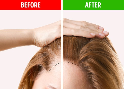 6. Thêm nhiều rau và protein vào chế độ ăn uống: Nếu muốn tóc chắc khỏe và dày, bạn nên thêm nhiều rau xanh và trái cây trong chế độ ăn uống. Tóc của chúng ta cần sắt, biotin và vitamin để phát triển khỏe mạnh. Nhiều loại rau, bao gồm rau bina, đậu và trái cây cũng là nguồn cung cấp vitamin, sắt tuyệt vời. Ngoài ra, chuối, đậu phộng và súp lơ có chứa biotin, còn ngũ cốc nguyên hạt, đậu nành được coi là nguồn protein tuyệt vời.