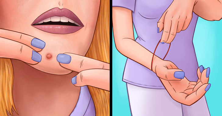 5. Nặn mụn: Đầu tiên, nặn mụn có thể làm cho chúng tồi tệ hơn và thậm chí gây ra sẹo. Ngoài ra, bạn có thể bị nhiễm trùng khi cố gắng nặn mụn. Do đó, đừng nên tùy ý nặn mụn trên mặt.