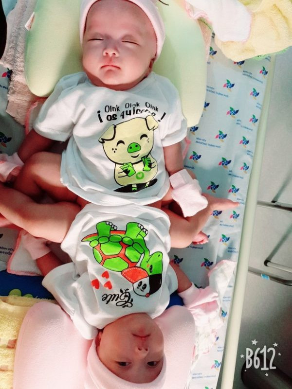 Bố mẹ bé cùng các chuyên gia vật lý trị liệu, các y bác sĩ phối hợp chăm sóc các cháu những việc nhỏ nhặt nhất trong sinh hoạt thường ngày như thay tã chung, mớm sữa, vệ sinh đặc biệt phần thân dính liền...