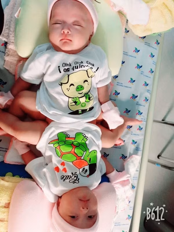 Bố mẹ bé cùng các chuyên gia vật lý trị liệu, các y bác sĩ phối hợp chăm sóc các cháu những việc nhỏ nhặt nhất trong sinh hoạt thường ngày như thay tã chung, mớm sữa, vệ sinh đặc biệt phần thân dính liền...