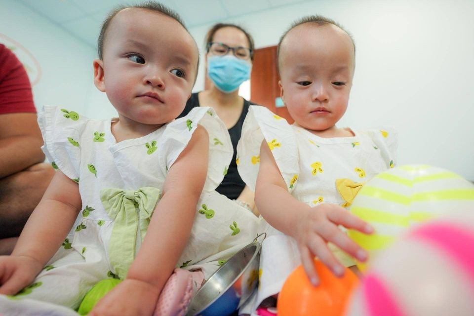 100 ngày sau ca đại phẫu tách rời, Hoàng Trúc Nhi và Hoàng Diệu Nhi (15 tháng tuổi) đã ổn định sức khỏe.