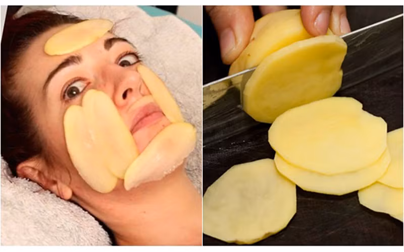 Khoai tây điều trị sắc tố da: Lấy chiết xuất nước khoai tây và rửa mặt với nó sau đó rửa mặt lại bằng nước ấm. Lặp lại phương pháp này hai lần một tuần để có được kết quả hiệu quả tốt nhất. Ảnh: Boldsky, BS. Video "Bí quyết làm đẹp của sao Việt". Nguồn: VTC.