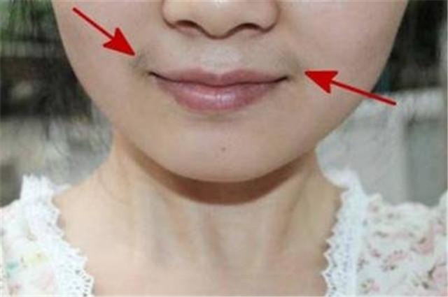 Bat benh “vung kin” qua cac dau hieu de thay tren khuon mat